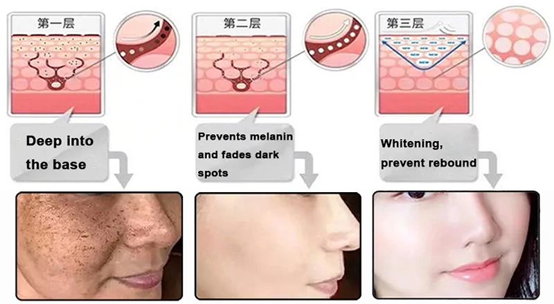 glabridin Whitening glabridin Whitening